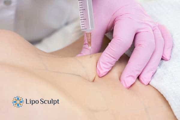 Aqualyx for Muffin Tops: What to Know Before Fat-Dissolving Injections 4 Are there risks Staffordshire?